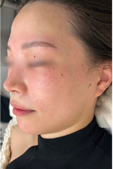 일본 고베에 위치한, 얼굴과 허브 성분을 이용한 피부 재생 전문점인 IROHA.