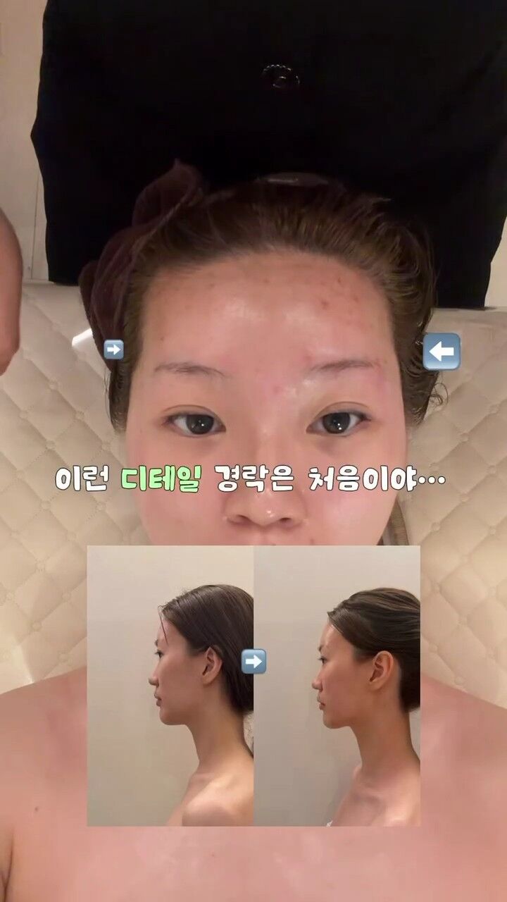 모모로그 x 디유에스테틱