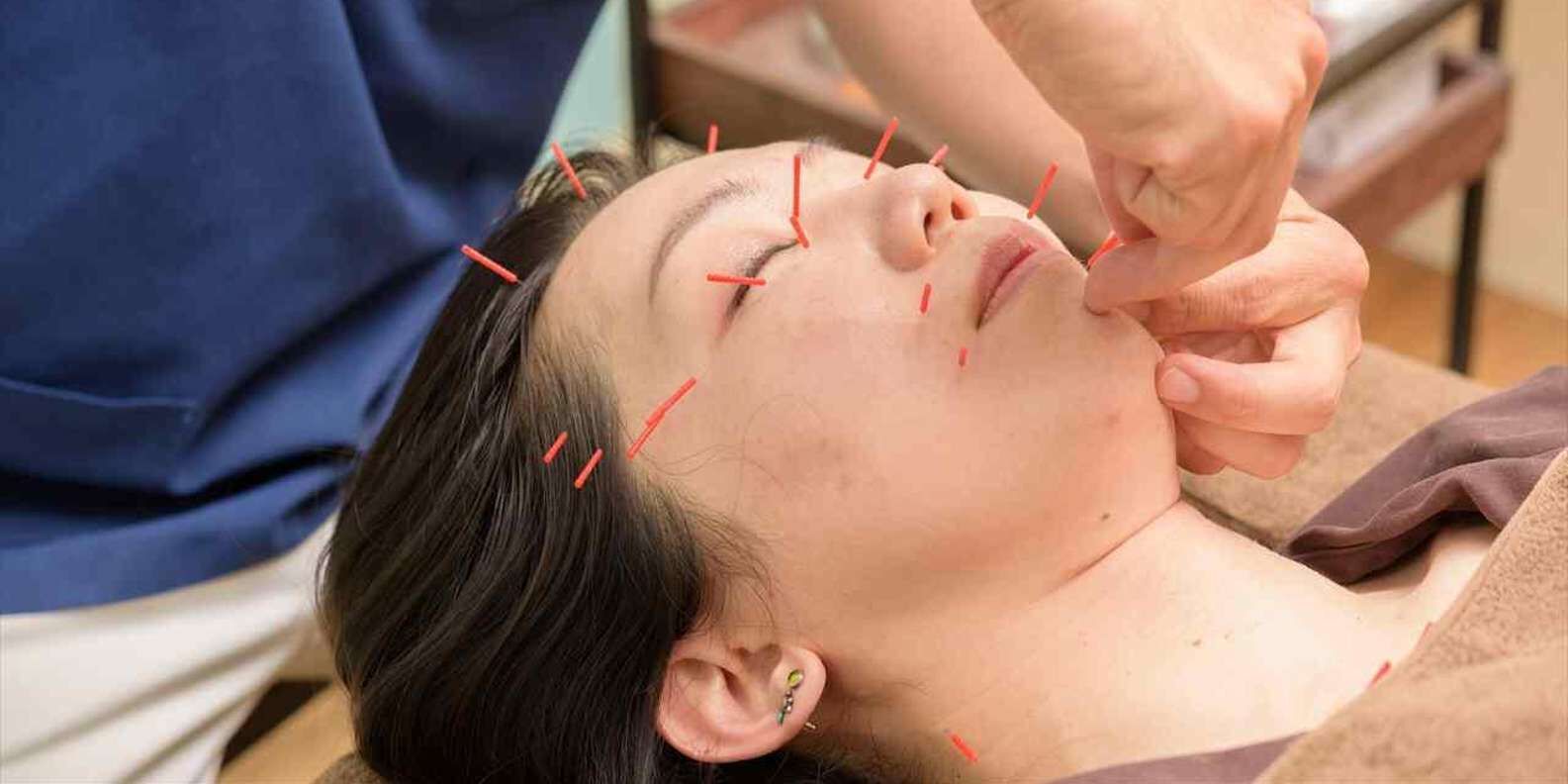 [즉시확정] 히로시마 국가자격 전문가 1:1 침술·카이로프랙틱 (90분)